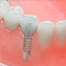 periodoncista en guayaquil